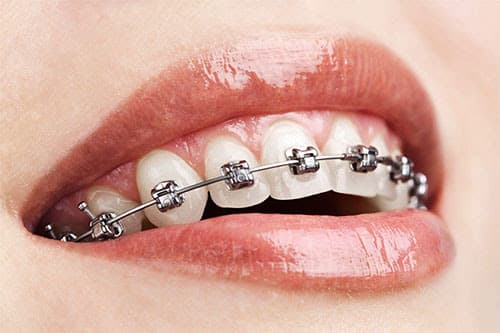 ORTHODONTICS