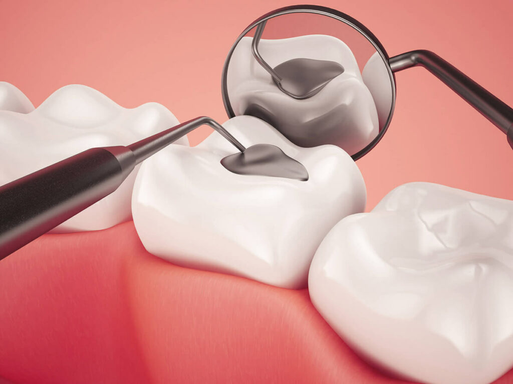 AESTHETIC FILLINGS